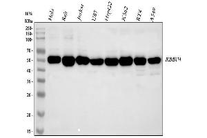 Western blot analysis of RbAp48 using anti-RbAp48 antibody (ABIN3043920). (Retinoblastoma Binding Protein 4 antibody  (C-Term))