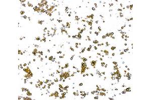 Immunocytochemistry (ICC) image for anti-Tubulin, beta 3 (TUBB3) (AA 400-450) antibody (ABIN7453957) (Recombinant TUBB3 antibody  (AA 400-450))