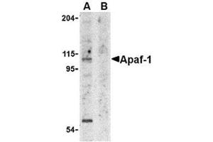 Image no. 2 for anti-Apoptotic Peptidase Activating Factor 1 (APAF1) (AA 12-28) antibody (ABIN319002) (APAF1 antibody  (AA 12-28))