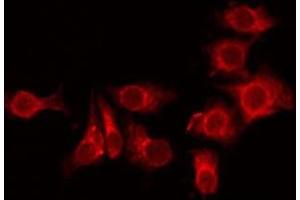 ABIN6275804 staining HuvEc by IF/ICC. (TMEM101 antibody  (Internal Region))