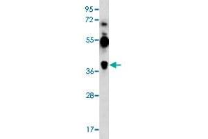 MAGEA12 antibody  (N-Term)