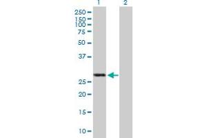 Western Blot analysis of IFIH1 expression in transfected 293T cell line by IFIH1 MaxPab polyclonal antibody. (IFIH1 antibody  (AA 1-221))