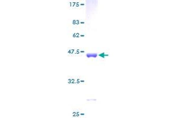 eIF4EBP1 Protein (AA 1-118) (GST tag)