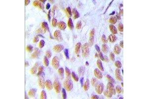 Immunohistochemistry (IHC) image for anti-High Mobility Group Box 1 (HMGB1) antibody (ABIN7303760)