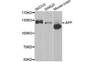 Western blot analysis of extracts of various cell lines, using APP antibody. (APP antibody)