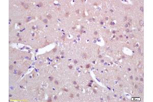 Formalin-fixed and paraffin embedded rat brain labeled with Rabbit Anti SPAG5/MAP126/Astrin Polyclonal Antibody, Unconjugated (ABIN672261) at 1:200 followed by conjugation to the secondary antibody and DAB staining (SPAG5 antibody  (AA 1101-1193))