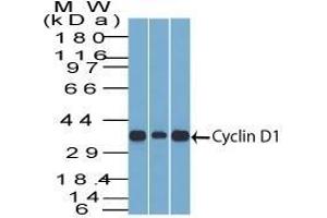 Western Blot Analysis of Cyclin D1 (1) C2C12, (2) HepG2, & (3) NIH3T3 cell lysate Cyclin D1 Mouse Monoclonal Antibody (DCS-6). (Cyclin D1 antibody)