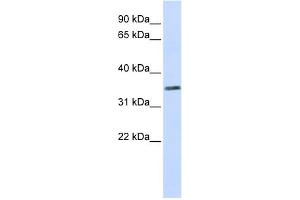 WB Suggested Anti-C2orf60 Antibody Titration:  0. (C2orf60 antibody  (Middle Region))