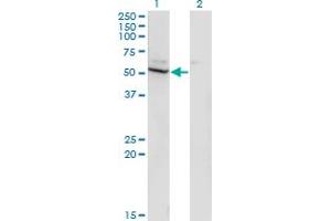 Western Blot analysis of CYP26B1 expression in transfected 293T cell line by CYP26B1 monoclonal antibody (M02), clone 2G7.