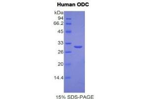 SDS-PAGE (SDS) image for Ornithine Decarboxylase 1 (ODC1) (AA 15-259) protein (His tag) (ABIN1171068)