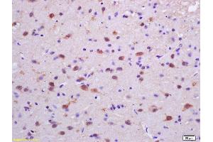 Formalin-fixed and paraffin embedded rat brain labeled with Rabbit Anti phospho-PKC delta (Tyr311) Polyclonal Antibody, Unconjugated (ABIN703270) at 1:200 followed by conjugation to the secondary antibody and DAB staining