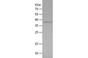 TACC1 Protein (AA 518-805) (His tag)