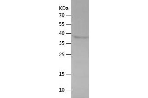 TACC1 Protein (AA 518-805) (His tag)