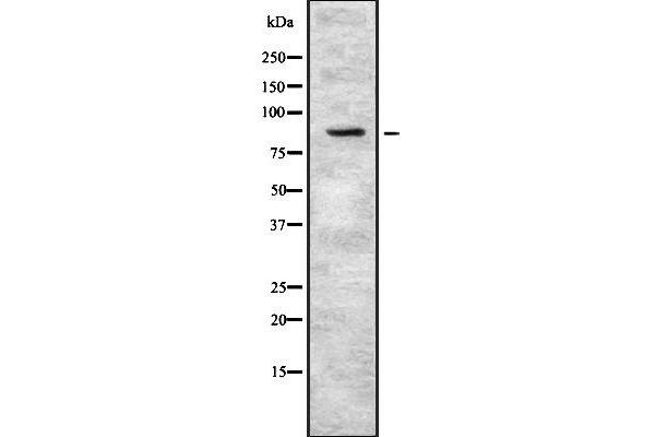 Plakophilin 3 Antikörper  (C-Term)