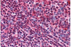 Human Tonsil (formalin-fixed, paraffin-embedded) stained with CD5L antibody ABIN214596 at 5 ug/ml followed by biotinylated goat anti-rabbit IgG secondary antibody ABIN481713, alkaline phosphatase-streptavidin and chromogen. (CD5L antibody  (N-Term))