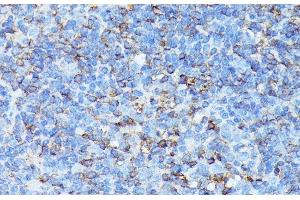 Immunohistochemistry of paraffin-embedded Mouse spleen using CXCR1 Polyclonal Antibody at dilution of 1:100 (40x lens). (CXCR1 antibody)