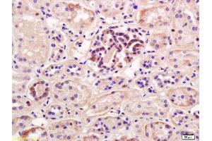 Formalin-fixed and paraffin embedded human kidney labeled with Rabbit Anti PEPT1 Polyclonal Antibody, Unconjugated (ABIN671961) at 1:200 followed by conjugation to the secondary antibody and DAB staining