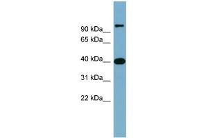 WB Suggested Anti-CCNDBP1 Antibody Titration: 0. (CCNDBP1 antibody  (Middle Region))