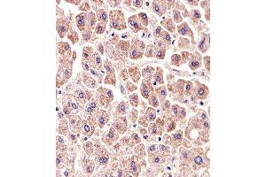 Paraformaldehyde-fixed, paraffin embedded human liver tissue, Antigen retrieval by boiling in sodium citrate buffer (pH6. (ALDH6A1 antibody)