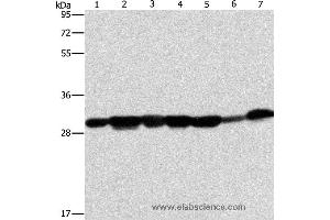 Western blot analysis of Human placenta tissue and A549 cell, mouse brain tissue and hepG2 cell, Raji cell and human fetal liver tissue, hela cell, using AK2 Polyclonal Antibody at dilution of 1:300 (Adenylate Kinase 2 antibody)