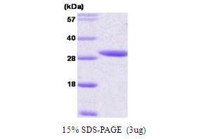 SDS-PAGE (SDS) image for 14-3-3 epsilon (YWHAE) (AA 1-255) protein (ABIN667700) (YWHAE Protein (AA 1-255))