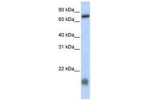 Image no. 1 for anti-Leber Congenital Amaurosis 5-Like (LCA5L) (N-Term) antibody (ABIN6740944)