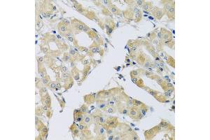 Immunohistochemistry of paraffin-embedded human stomach using ABCF2 antibody (ABIN5972445) at dilution of 1/100 (40x lens).