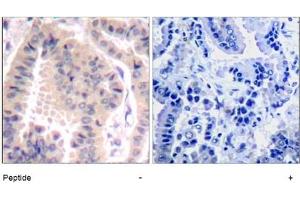Image no. 1 for anti-Eukaryotic Translation Initiation Factor 4B (EIF4B) (AA 420-424) antibody (ABIN401568) (EIF4B antibody  (AA 420-424))