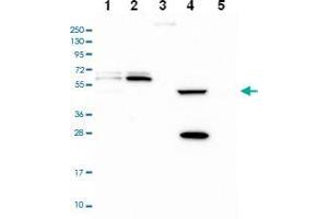 Western blot analysis of Lane 1: RT-4 Lane 2: U-251 MG Lane 3: Human Plasma Lane 4: Liver Lane 5: Tonsil with PPAN-P2RY11 polyclonal antibody .