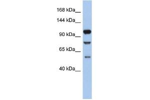 WB Suggested Anti-TLR9 Antibody Titration: 0. (TLR9 antibody  (N-Term))