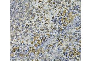 Immunohistochemistry of paraffin-embedded Rat spleen using CEBPE Polyclonal Antibody at dilution of 1:100 (40x lens). (CEBPE antibody)