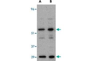 Western blot analysis of PDCD4 in A-20 cell lysate with PDCD4 polyclonal antibody  at (A) 0. (PDCD4 antibody  (C-Term))