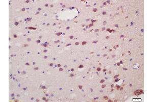 Formalin-fixed and paraffin embedded rat brain labeled with Anti-Spinophilin/Neurabin 2 Polyclonal Antibody, Unconjugated (ABIN1386710) at 1:200 followed by conjugation to the secondary antibody and DAB staining (PPP1R9B antibody  (AA 358-460))