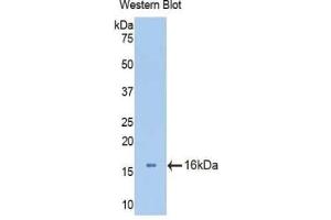 Detection of Recombinant AGC, Mouse using Polyclonal Antibody to Aggrecan (AGC) (Aggrecan antibody  (AA 34-147))