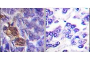 Immunohistochemistry analysis of paraffin-embedded human pancreas tissue, using MSK1 (Ab-360) Antibody.