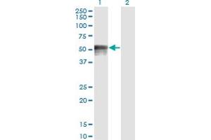 Western Blotting (WB) image for anti-Forkhead Box A1 (FOXA1) (AA 367-472) antibody (ABIN516560)