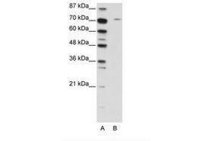 Image no. 1 for anti-Leucine Zipper, Putative Tumor Suppressor 1 (LZTS1) (C-Term) antibody (ABIN202796) (LZTS1 antibody  (C-Term))