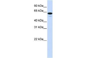 WB Suggested Anti-ZNF655 Antibody Titration:  0. (ZNF655 antibody  (Middle Region))