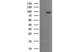 Image no. 1 for anti-Phosphoinositide-3-Kinase, Regulatory Subunit 5 (PIK3R5) antibody (ABIN1500218) (PIK3R5 antibody)