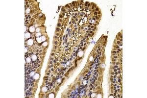 Immunohistochemistry of paraffin-embedded mouse jejunum using XPO5 antibody. (XPO5 antibody  (AA 925-1204))