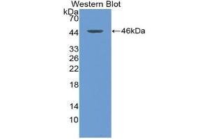 Western blot analysis of the recombinant protein. (Thymic Stromal Lymphopoietin antibody  (AA 21-138))