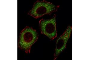Fluorescent image of  cell stained with NFKBp65 Antibody (C-term) (ABIN1537682 and ABIN2849713).