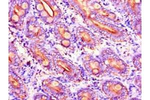 Immunohistochemistry of paraffin-embedded human small intestine tissue using ABIN7149322 at dilution of 1:100 (DYNC2H1 antibody  (AA 1928-2065))