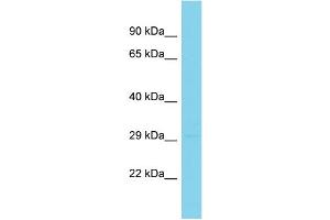 Host: Rabbit Target Name: Il20rb Sample Type: Mouse Stomach lysates Antibody Dilution: 1. (IL20RB antibody  (Middle Region))