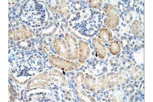 Image no. 1 for anti-Frizzled Family Receptor 7 (FZD7) (C-Term) antibody (ABIN6736223) (FZD7 antibody  (C-Term))