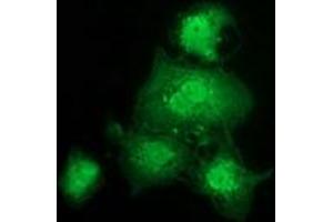 Anti-GSTT2 mouse monoclonal antibody (ABIN2453887) immunofluorescent staining of COS7 cells transiently transfected by pCMV6-ENTRY GSTT2 (RC200040). (GSTT2 antibody)