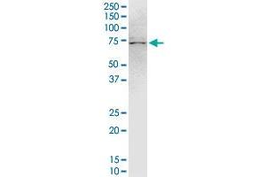 TRIM47 monoclonal antibody (M02), clone 3C8. (TRIM47 antibody  (AA 539-638))