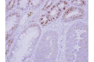 Image no. 1 for anti-Glucokinase (Hexokinase 4) Regulator (GCKR) (AA 1-214) antibody (ABIN1501890) (GCKR antibody  (AA 1-214))
