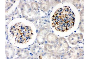 Nestin was detected in paraffin-embedded sections of rat kidney tissues using rabbit anti- Nestin Antigen Affinity purified polyclonal antibody at 1 μg/mL. (Nestin antibody  (N-Term))