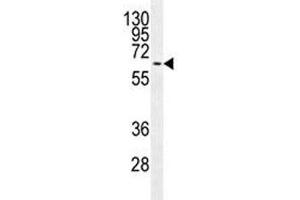 MAPK15 antibody western blot analysis in MCF-7 lysate. (MAPK15 antibody)